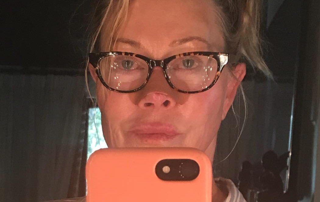 Melanie Griffith enseña cómo le ha afectado el cáncer de piel en la nariz