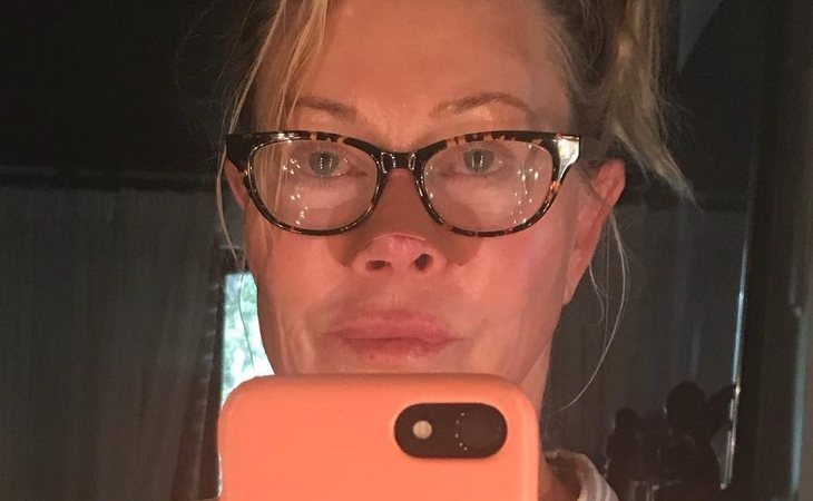 Melanie Griffith enseña cómo le ha afectado el cáncer de piel en la nariz