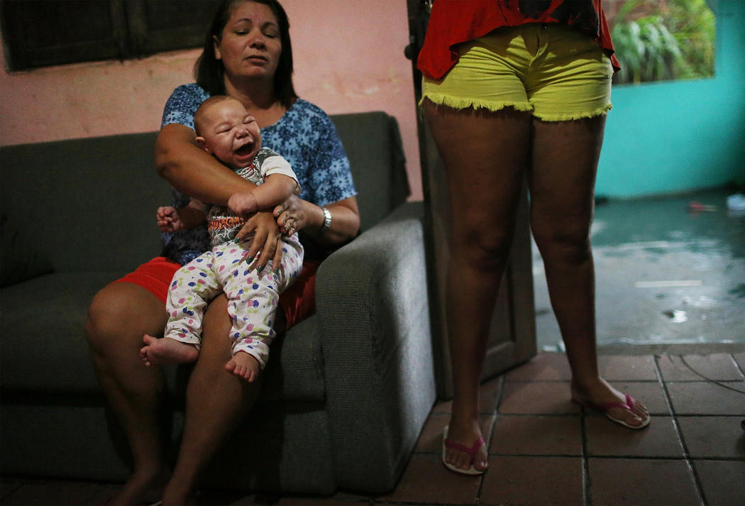 Un bebé con microcefalia en Brasil