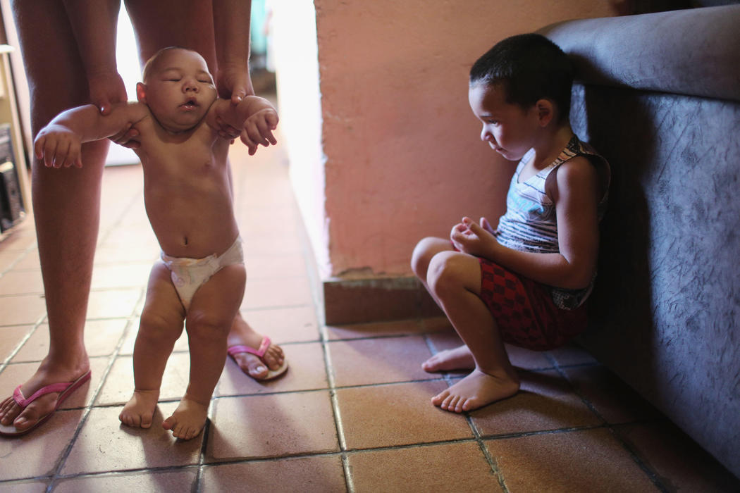 Más de 4.000 casos de microcefalia en Brasil